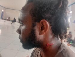 4 orang terluka dalam pembubaran aksi Hari HAM Sedunia di Jayapura