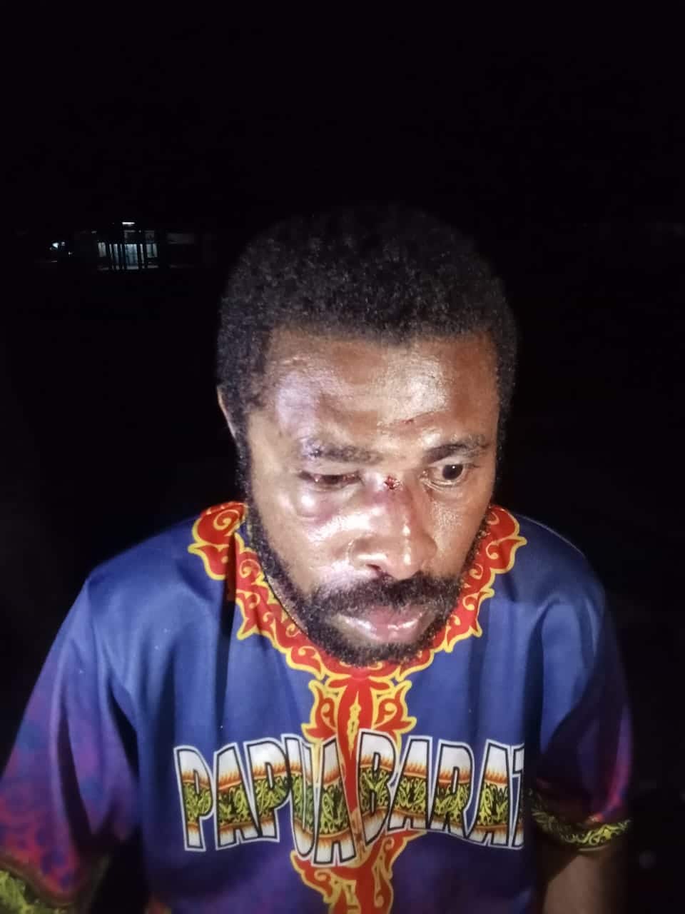 Dewan Adat Domberai kecam penganiayaan terhadap tiga pemuda yang diduga dilakukan polisi 1 penganiayaan