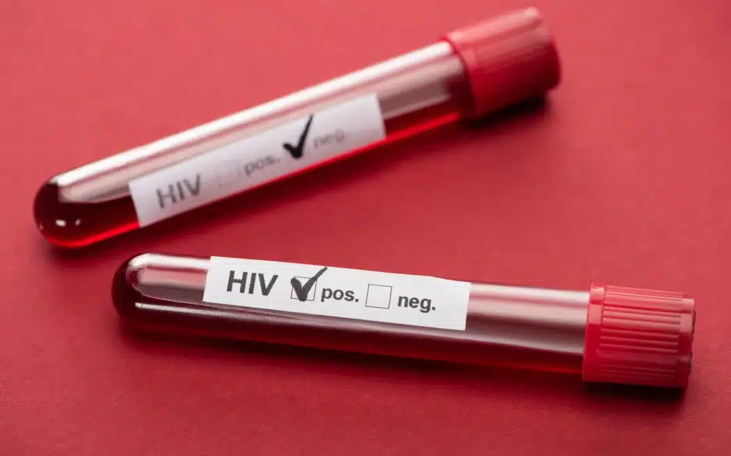 Asisten Menteri Kesehatan: 'Krisis Nasional' HIV di Fiji 1 HIV