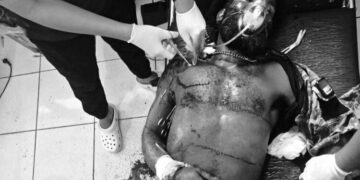 Ony Enumbi (27), who was fatally shot by members of the Damai Cartenz Task Force in Wiyugwi Village, Mulia District, Puncak Jaya Regency, Central Papua, on Monday (April 20, 2026) – Supplied