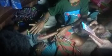 One of the children reported to have been injured by gunfire in Puncak Regency – Courtesy of Jubi