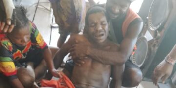 Jubi](https://jubi.id/wp-content/uploads/2026/06/1000877419.jpg)One of the teenagers reportedly shot in Titigi Village, Sugapa District, Intan Jaya Regency, Central Papua, Monday (29/06/2026) – Photo courtesy of Jubi