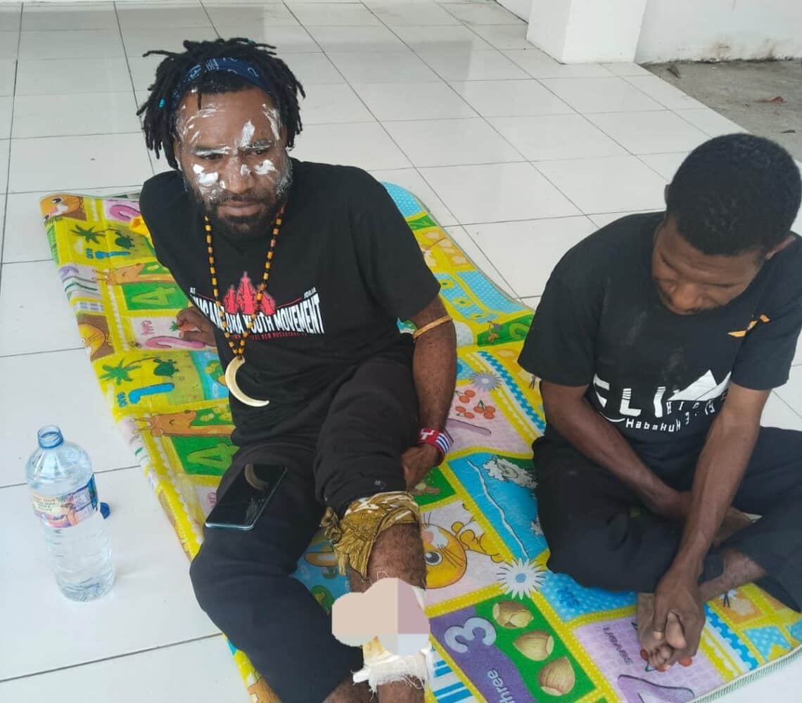 Wakil ketua BEM Uncen tertembak saat ricuh