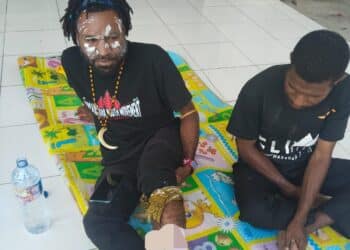 Wakil ketua BEM Uncen tertembak saat ricuh