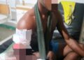 Korban penembakan Nduga dirawat di Mimika 5 Korban penembakan Nduga